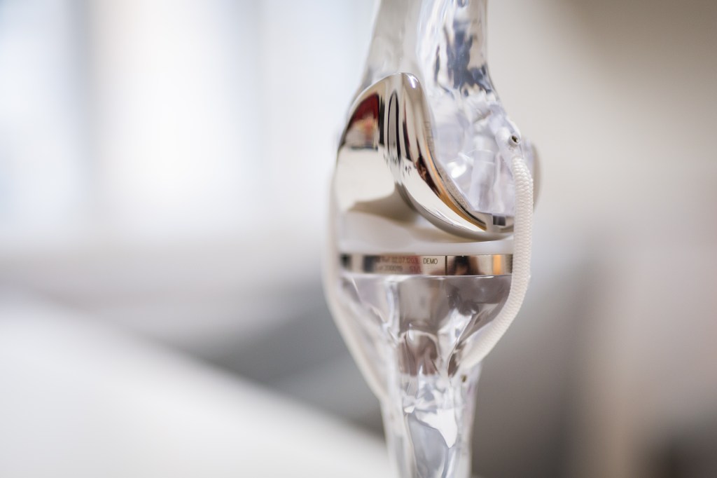 Orthopäde Graz: Knieprothese, Knieoperation, Knieschmerzen