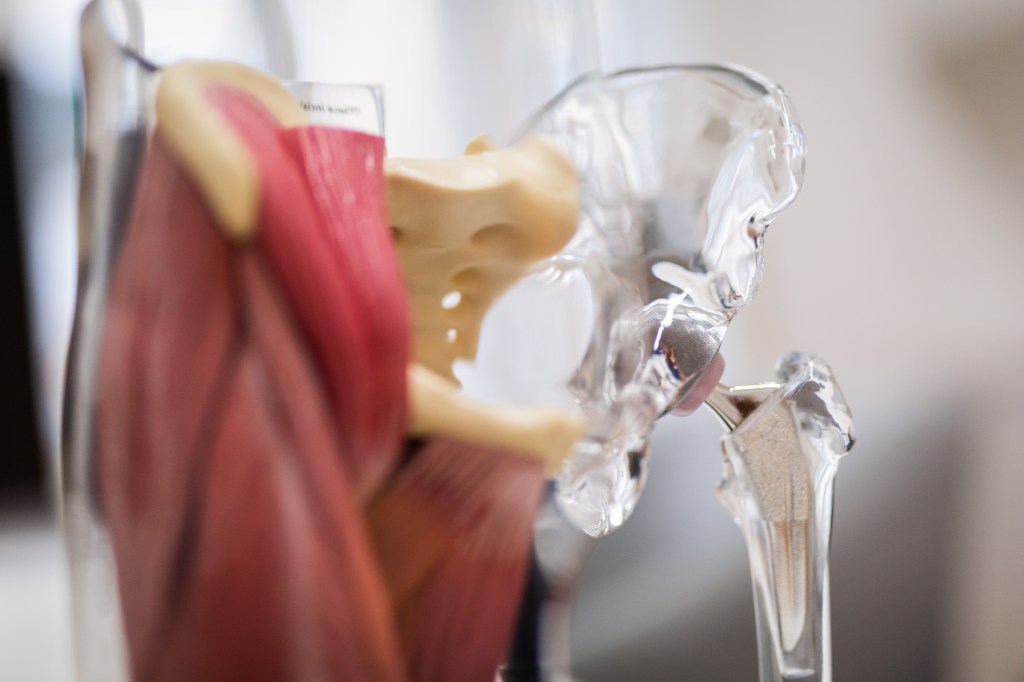 Orthopäde Graz: Hüftschmerzen, Hüftprothese, Künstliches Hüftgelenk, Arthrose